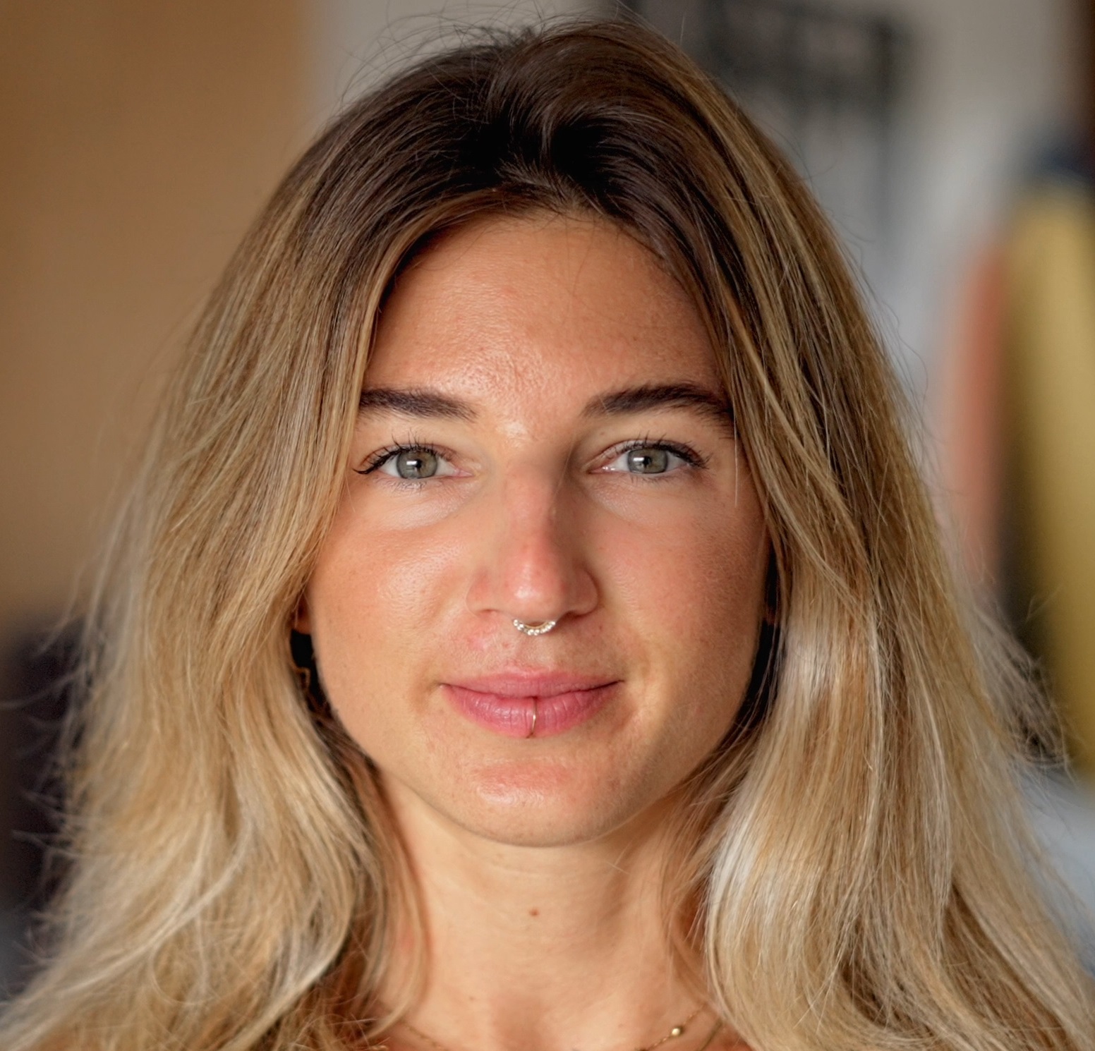 Anouk Recovery Story